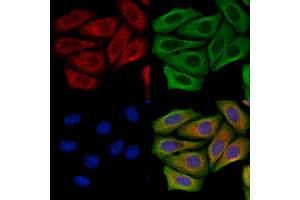 FUT6 Antibody staining Hela cells by IF/ICC. (FUT6 anticorps  (N-Term))