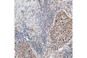 IHC analysis of U1-C/SNRPC using anti-U1-C/SNRPC antibody (ABIN7599016).