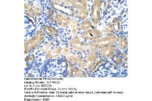 Rabbit Anti-MTHFSD Antibody  Paraffin Embedded Tissue: Human Kidney Cellular Data: Epithelial cells of renal tubule Antibody Concentration: 4.