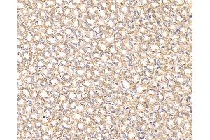 Immunohistochemistry analysis of paraffin-embedded Rat stomach cancer using CK-7 Monoclonal Antibody at dilution of 1:300. (Cytokeratin 7 anticorps)