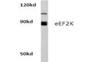 Image no. 1 for anti-Eukaryotic Elongation Factor-2 Kinase (EEF2K) antibody (ABIN265393) (EEF2K anticorps)
