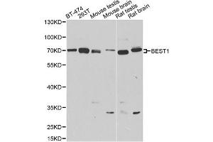 Western blot analysis of extracts of various cell lines, using BEST1 antibody (ABIN4903043) at 1:1000 dilution. (Bestrophin 1 anticorps)