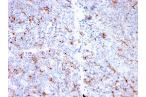 Formalin-fixed, paraffin-embedded human Tonsil stained with S100A8/A9 Complex Recombinant Rabbit Monoclonal Antibody (MAC3157R).