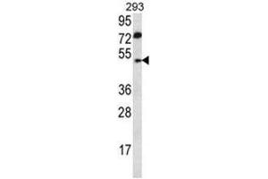 ABHD2 Antibody (Center) western blot analysis in 293 cell line lysates (35 µg/lane). (ABHD2 anticorps  (Middle Region))