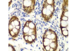 Immunohistochemistry of paraffin-embedded Human colon using GIPC2 Polyclonal Antibody at dilution of 1:100 (40x lens). (GIPC2 anticorps)
