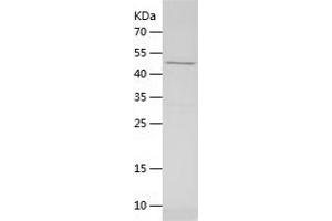 Western Blotting (WB) image for Nuclear Receptor Subfamily 2, Group F, Member 6 (NR2F6) (AA 1-404) protein (His tag) (ABIN7124214)