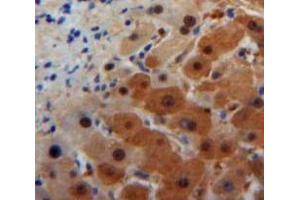 Used in DAB staining on fromalin fixed paraffin-embedded Liver tissue (ORM1 anticorps  (AA 19-207))