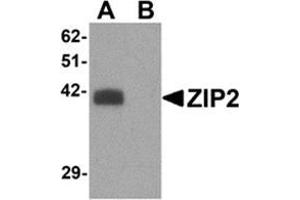 Western blot analysis of ZIP2 in rat brain tissue lysate with ZIP2 antibody at 1 μg/ml in (A) the absence and (B) the presence of blocking peptide.