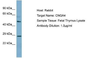 Host: Rabbit Target Name: CNGA4 Sample Type: Fetal Thymus lysates Antibody Dilution: 1. (CNGA4 anticorps  (N-Term))