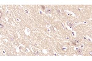 Detection of CD97 in Human Cerebrum Tissue using Monoclonal Antibody to Cluster Of Differentiation 97 (CD97)