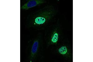 Immunofluorescence analysis of HeLa cells using WHSC2 mouse mAb (green).