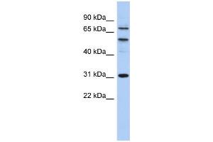WB Suggested Anti-SSRP1 Antibody Titration: 0. (SSRP1 anticorps  (Middle Region))
