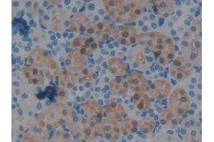 DAB staining on IHC-P; Samples: Rat Kidney Tissue