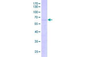 Image no. 1 for Histone H1.4 (HIST1H1E) (AA 1-219) protein (GST tag) (ABIN1989647)