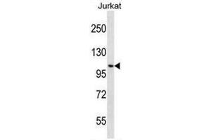 CENPC1 Antibody (Center) western blot analysis in Jurkat cell line lysates (35µg/lane).