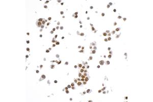 Immunocytochemistry (ICC) image for anti-SWI/SNF Related, Matrix Associated, Actin Dependent Regulator of Chromatin, Subfamily A, Member 4 (SMARCA4) (AA 75-125) antibody (ABIN7453997)