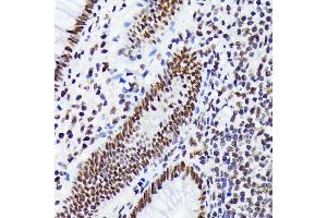 Immunohistochemistry of paraffin-embedded human appendix using EWSR1 Rabbit mAb (ABIN7267053) at dilution of 1:100 (40x lens). (EWSR1 anticorps)
