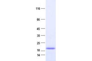 Validation with Western Blot