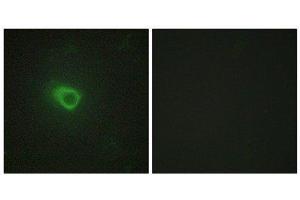 Immunofluorescence (IF) image for anti-Janus Kinase 1 (JAK1) (N-Term) antibody (ABIN1849256) (JAK1 anticorps  (N-Term))