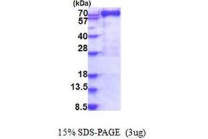 SDS-PAGE (SDS) image for Myxovirus Resistance Protein 1 (MX1) (AA 1-662) protein (His tag) (ABIN5853896)