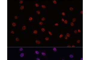 Immunofluorescence analysis of C6 cells using MYCT1 Polyclonal Antibody at dilution of 1:100. (Myc Target 1 anticorps)