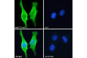 ABIN570923 Immunofluorescence analysis of paraformaldehyde fixed 3T3-L1 cells, permeabilized with 0. (TREM2 anticorps  (Internal Region))