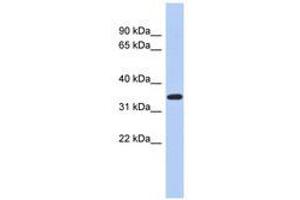 Image no. 1 for anti-Kruppel-Like Factor 6 (KLF6) (AA 71-120) antibody (ABIN6740430)