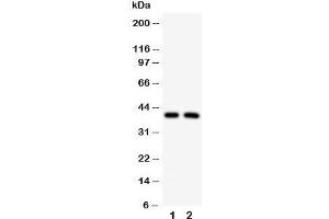 Western blot testing of IRF2 antibody and Lane 1:  HeLa;  2: MCF-7 cell lysate (IRF2 anticorps  (C-Term))