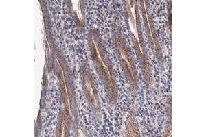 Immunohistochemical staining (Formalin-fixed paraffin-embedded sections) of human stomach with YARS2 polyclonal antibody  shows cytoplasmic positivity in glandular cells. (YARS2 anticorps)