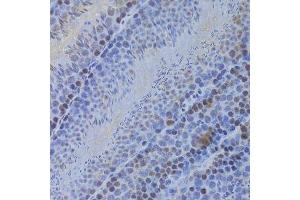 Immunohistochemistry of paraffin-embedded mouse testis using HELLS Antibody. (HELLS anticorps  (AA 719-838))
