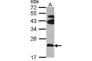 WB Image Sample (30 ug of whole cell lysate) A: Hela 12% SDS PAGE FAM18B antibody antibody diluted at 1:1000 (TVP23C/FAM18B2 anticorps  (Internal Region))