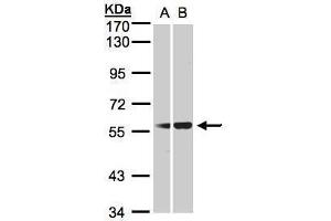 WB Image Sample(30 ug whole cell lysate) A:293T B:HeLa S3, 7.