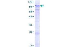 Image no. 1 for UDP-N-Acetyl-alpha-D-Galactosamine:polypeptide N-Acetylgalactosaminyltransferase 7 (GalNAc-T7) (GALNT7) (AA 1-657) protein (GST tag) (ABIN1354754)
