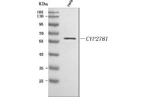 Western blot analysis of CYP27B1 using anti-CYP27B1 antibody (ABIN7600929).