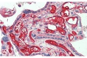 Detection of IL22Ra2 in Human Placenta Tissue using Polyclonal Antibody to Interleukin 22 Receptor Alpha 2 (IL22Ra2) (IL22RA2 anticorps  (AA 31-223))