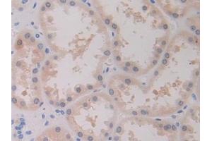Detection of BRCA1 in Human Kidney Tissue using Polyclonal Antibody to Breast Cancer Susceptibility Protein 1 (BRCA1)