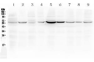 Western blot analysis of ESR2 using anti-ESR2 antibody . (ESR2 anticorps  (AA 289-501))
