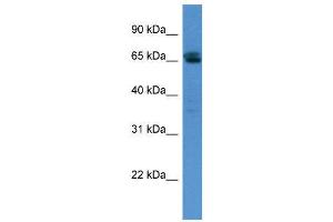 WB Suggested Anti-SMARCD3  Antibody Titration: 0. (SMARCD3 anticorps  (N-Term))