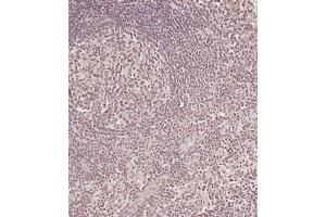 Immunohistochemical analysis of (ABIN6243102 and ABIN6578913) on paraffin-embedded Human tonsil tissue. (CDC25A anticorps  (Ser124))