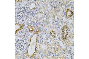 Immunohistochemistry of paraffin-embedded rat kidney using KRT20 Antibody. (KRT20 anticorps  (AA 245-424))