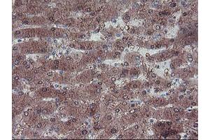 anti-LIM Homeobox 1 (LHX1) (AA 100-362) antibody