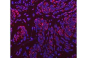 anti-Vacuolar Protein Sorting 53 Homolog (VPS53) (AA 11-699) antibody