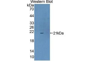 Western blot analysis of the recombinant protein. (Complexin 1 anticorps  (AA 1-134))
