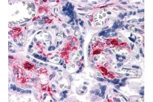 Immunohistochemical analysis of paraffin-embedded human Liver tissues using NKX3A antibody (NKX3-1 anticorps)