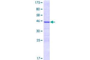 Image no. 1 for CGG Triplet Repeat Binding Protein 1 (CGGBP1) (AA 1-167) protein (GST tag) (ABIN1349251)