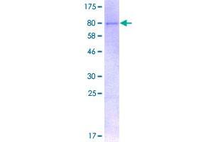 Image no. 1 for Ubiquitin Specific Peptidase 3 (USP3) (AA 1-520) protein (GST tag) (ABIN1324784)