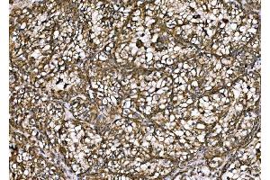 IHC analysis of DLAT using anti-DLAT antibody (ABIN7602307). (DLAT anticorps  (AA 69-642))