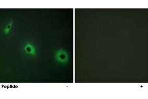 Immunofluorescence analysis of HepG2 cells, using CELSR3 polyclonal antibody . (CELSR3 anticorps)