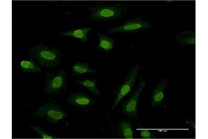 Immunofluorescence of monoclonal antibody to PDE3A on HeLa cell.