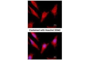 ICC/IF Image Immunofluorescence analysis of methanol-fixed HeLa, using Protein C, antibody at 1:500 dilution. (PROC anticorps)